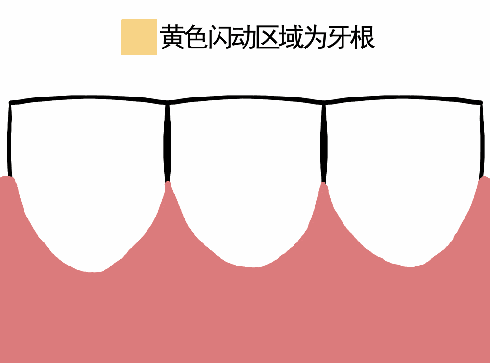 微信图片_20250416084420.gif