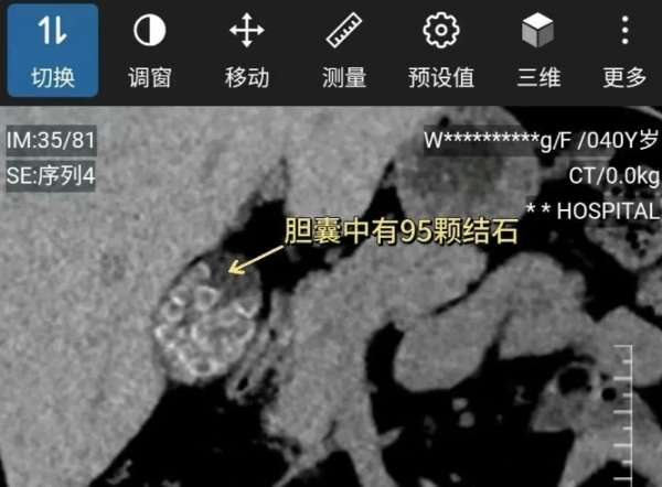 微信截图_20250527083708.png